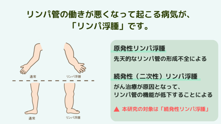 皮脂欠乏性湿疹およびうったい性皮膚炎