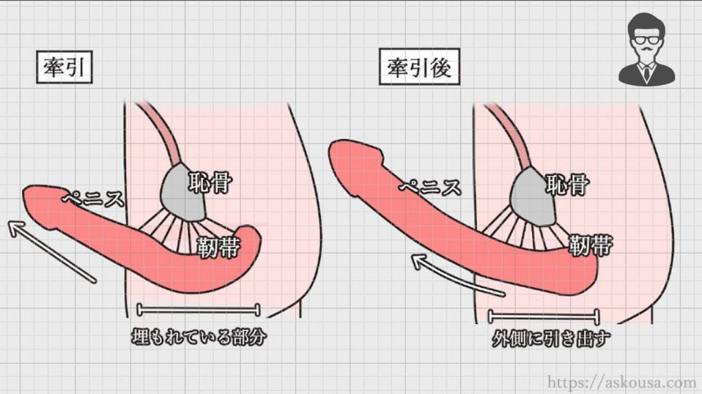 でかいちんこの基準とは？日本人平均や大きくする方法を解説 |【公式】ユナイテッドクリニック