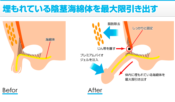 短小の基準は？短いちんこのちん長を伸ばし、粗チンを卒業する方法まとめ | Men's Chinchi