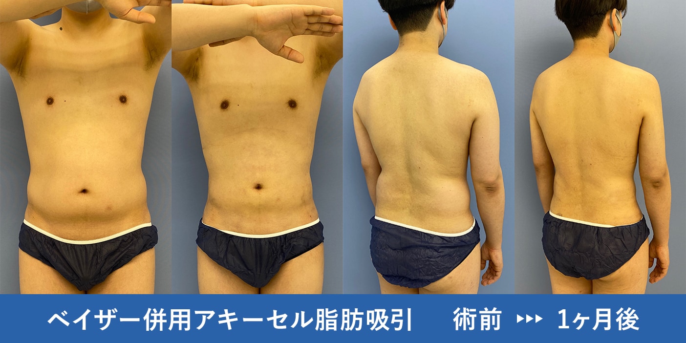 男性版】ウエストダイエットの効果を加速させる方法 | 男のためのダイエットマニュアル