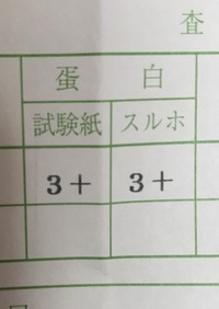 健康診断前日にオナニーはダメ！？尿検査前日に自慰した場合の対処法 - 夜の保健室