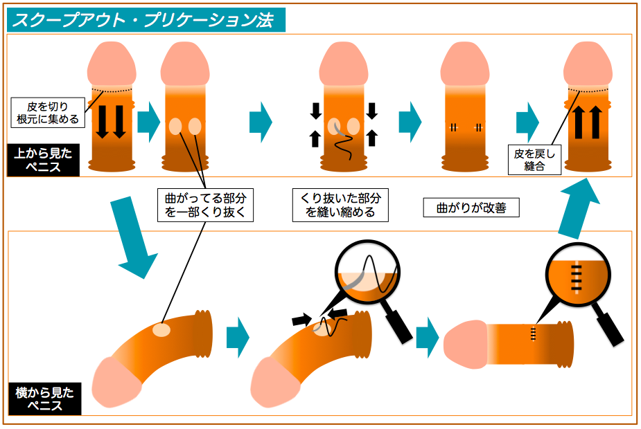 ツルツルプリケツに下反りちんこで生掘り