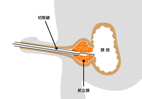 前立腺肥大症・がんのお悩みは松戸市の桐友クリニック新松戸