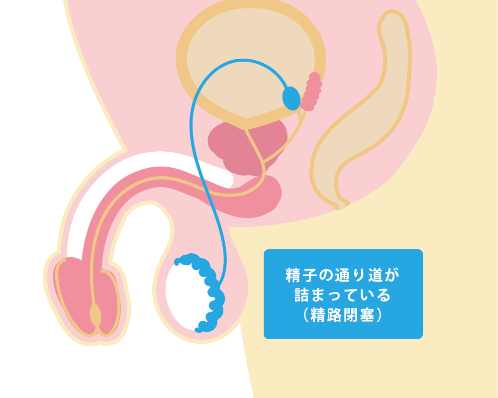 妊活男性にオススメ！精子力アップのレシピ-おむつのムーニー 公式 ユニ・チャーム