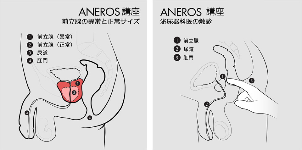 アネロス質問箱：アナル洗浄＆道具メンテのやり方は？ | アネロスジャパン