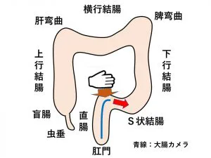 S字結腸に射精されるまでイキっぱなしな個性事故 - 同人誌 - エロ漫画