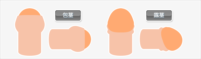 仮性包茎矯正 勃起不全 早漏改善