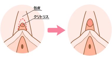 クリトリスにも勃起や包茎がある？ 仕組みやチェック方法を解説 ｜ iro