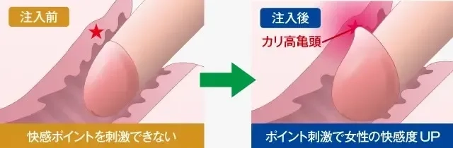 女性が喜ぶカリ高ペニスとは何cm？メリット・作り方を徹底解説 | ザヘルプM