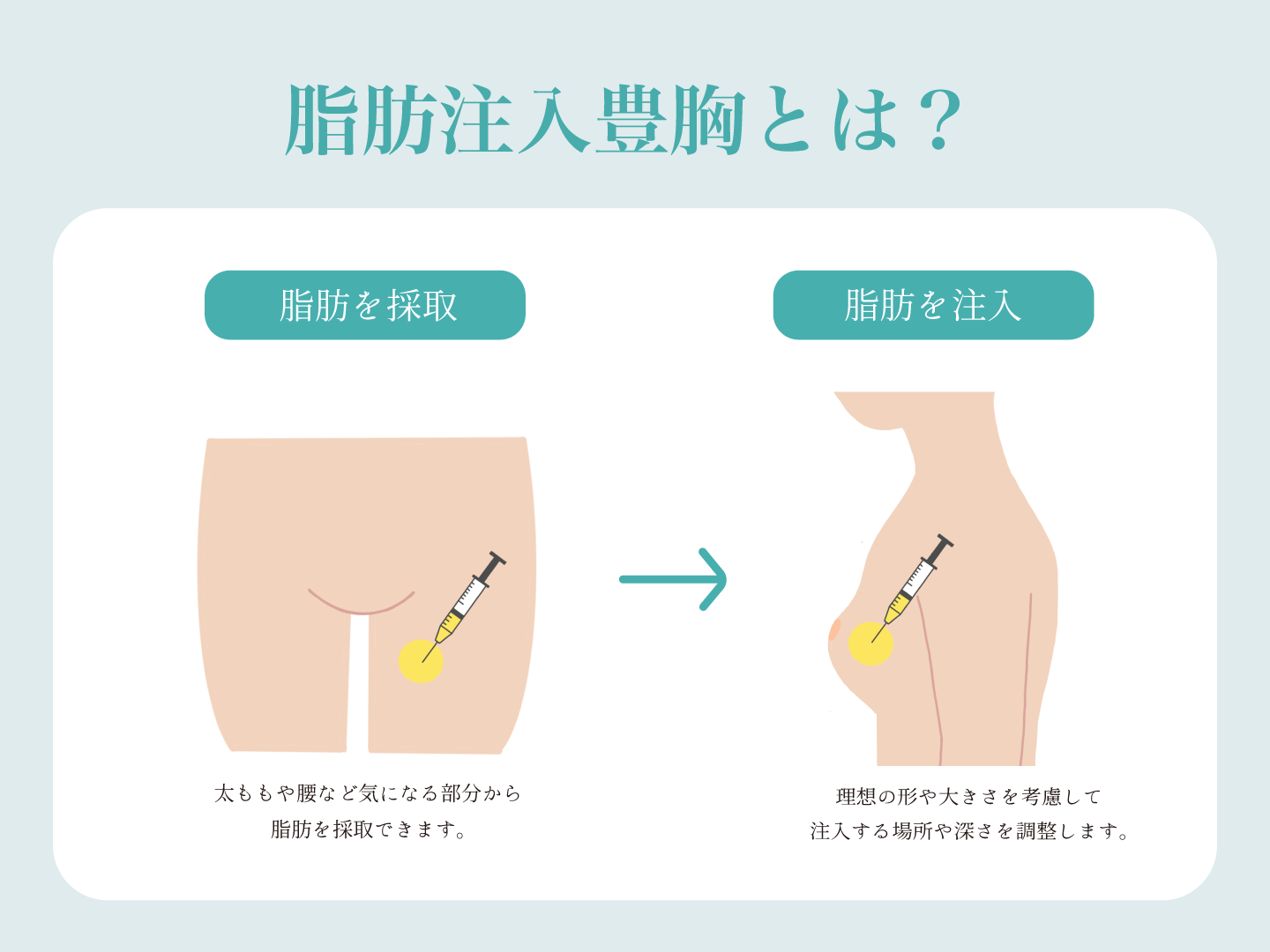 男の胸の脂肪はコレで落とそう！腕立て伏せじゃ落ちない？ - Fitmo