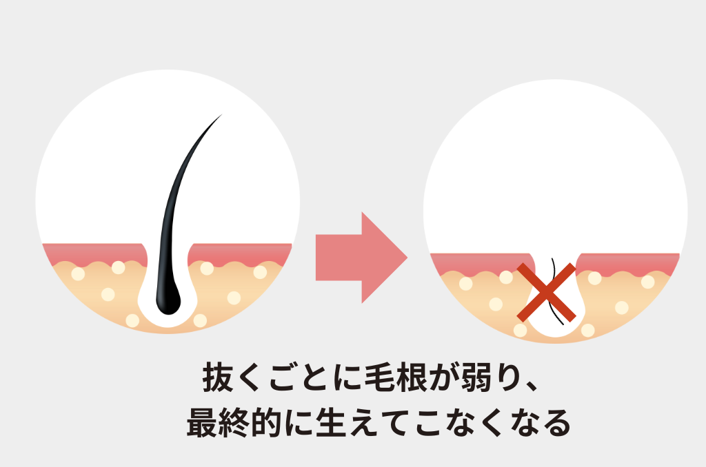 足の甲の毛は処理すべき？医療脱毛をおすすめする理由 - 銀座・名古屋・心斎橋の美肌治療は椿クリニック