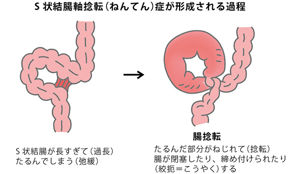 Amazon.co.jp: 日本メーカー国内製造 (日本ブランド) ワールドウェルネスクリむきキープジェル女性の為のクリーム