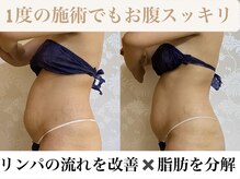 姫路で人気のダイエット徹底比較！ダイエットが安いコスパ最強-No.1のクリニックはここだ！ | 美容医療の情報WEBマガジン「マイクリニック」