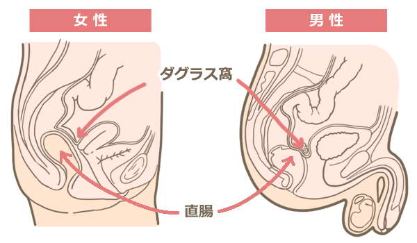 浣腸体験凄まじい嗚咽と共に体を硬直させて果てた二十代の人妻さんwww hな体験談 -