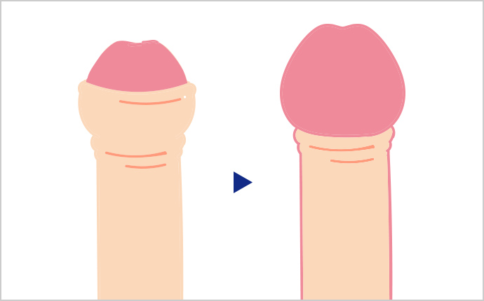 ペニスを長く太く！増大チントレ方法４選【亀頭・竿】