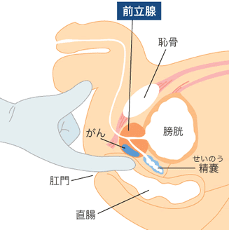 4月【東京、横浜、静岡】前立腺マッサージ・前立腺ドライオーガズム講座】安全な前立腺マッサージとドライオーガズムへの導き方！付録講座つき | 