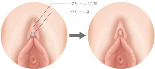 Gスポットはどこにある？ない人もいる？ 見つけ方・開発方法を紹介 |