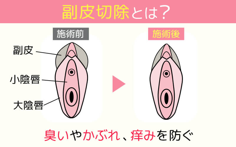 クリトリス勃起とは？勃つ理由とやり方 - 夜の保健室