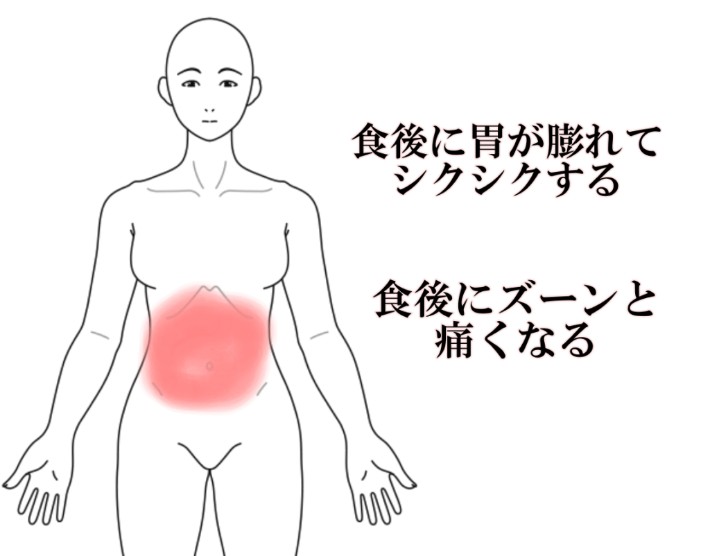 症例»股関節（鼡径部）の痛み - 養気院ようきいん｜群馬県伊勢崎市の鍼灸院