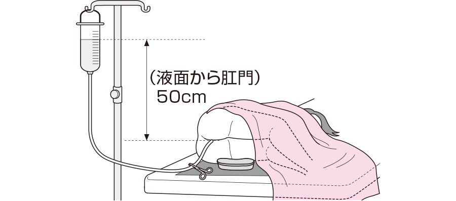 浣腸時、カテーテルを10cm以上挿入しないのはなぜ？｜浣腸 | 看護roo![カンゴルー]