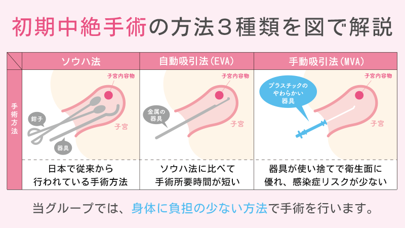 妊娠中絶の精神的な影響｜胎児異常による中絶は心理的負担が大きいので特にケアが必要 | 東京・ミネルバクリニック