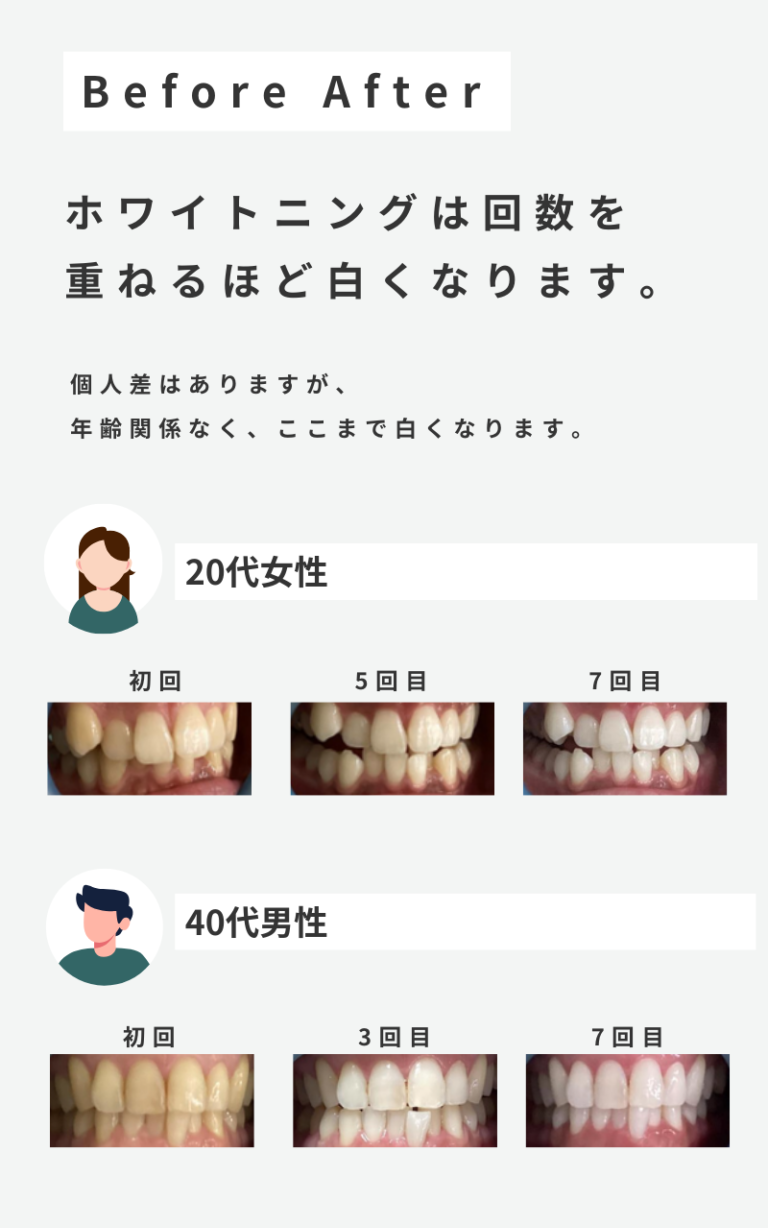 川崎のホワイトニング歯科医院・サロンを徹底調査【9選】 - ホワイトニングメディア