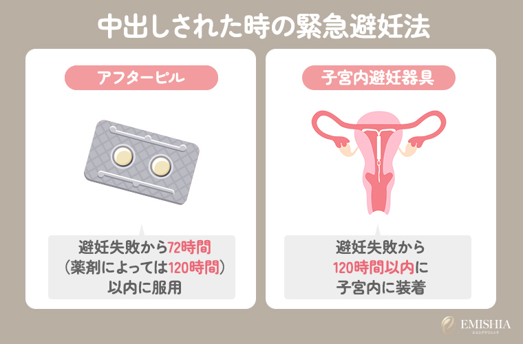 NNソープ嬢は中出しの後どうやってマンコを洗うべき？正しい洗い方を解説 | ザウパー風俗求人