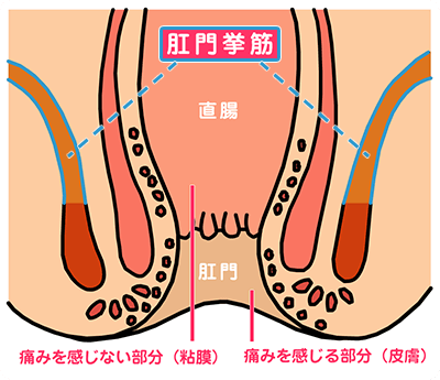 男と女、どちらが痔になりやすい？ ｜痔の治療なら 東京青山 平田肛門科医院