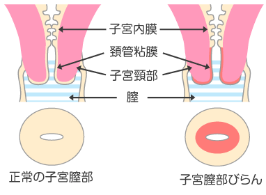 ヤリチンが解説】まんこの感触ってどんなの？セックス時の彼の反応で分かる！ | Trip-Partner[トリップパートナー]