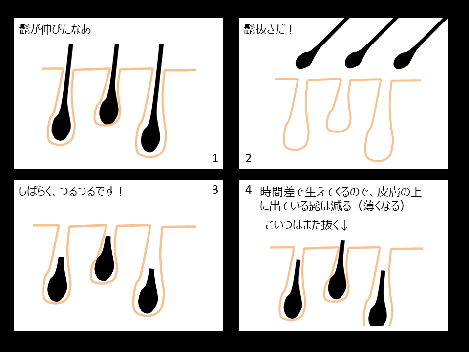 あご髭を抜くのが楽しい！髭抜きに潜む注意点や正しい自己処理方法を解説