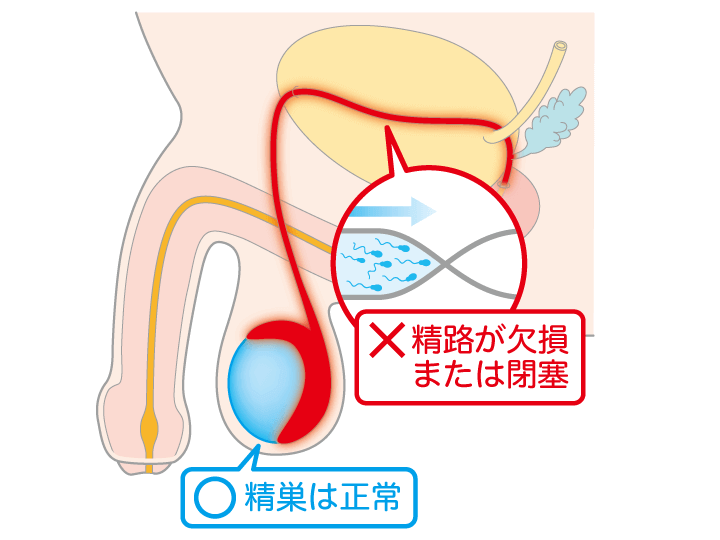 精液とは？精子との違いや色からわかる健康状態 |【公式】ユナイテッドクリニック