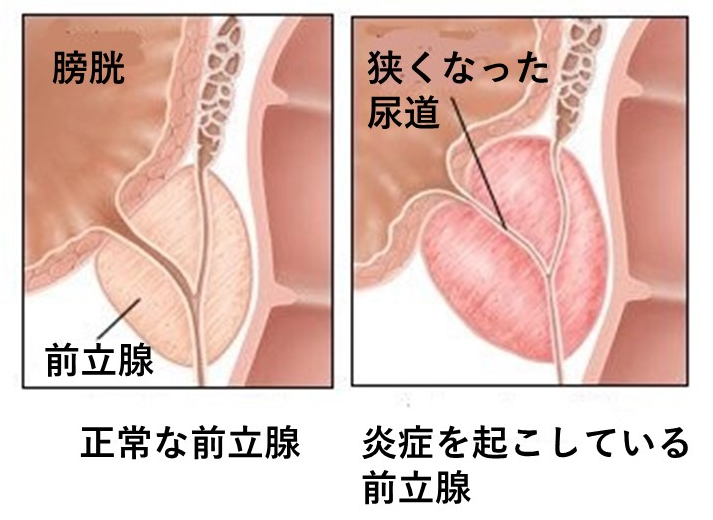 20%OFF】世話焼き幼馴染みの甘々囁き乳首&前立腺マッサージ [えむおな] |