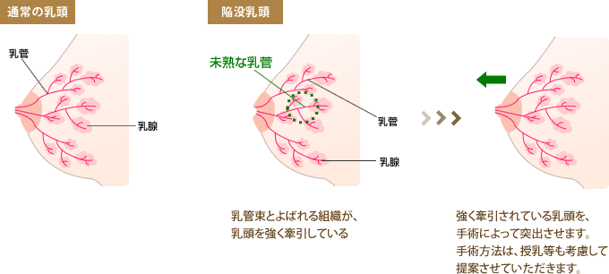 求人情報｜僕たちは乳首が好き！！大阪店（日本橋/デリヘル）