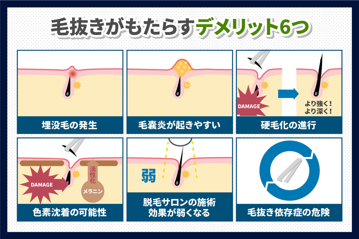 毛を抜く」自己処理はNG！脱毛中にムダ毛をなくす正しい処理方法 | メンズ脱毛百科事典 リンクスペディア