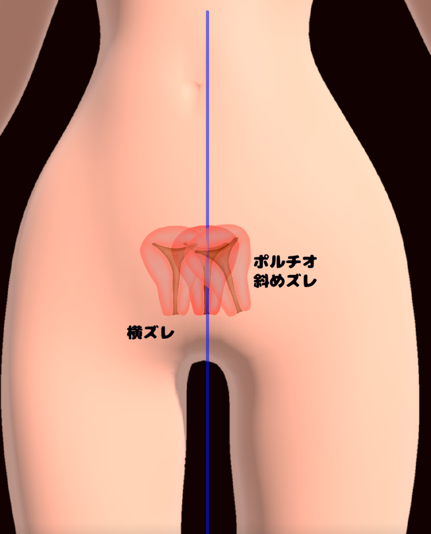 女性のお悩み（膣の違和感）｜東京の婦人科相談は渋谷文化村通りレディスクリニック｜渋谷文化村通りレディスクリニック