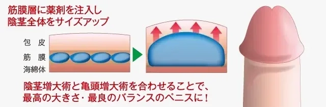 こどもの包茎はなるべく手術しない | 広島大学大学院 医系科学研究科 外科学