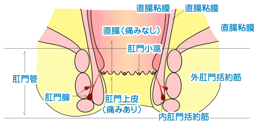 ショーツがお尻に食い込むのはなぜ？女性のための食い込み対処法