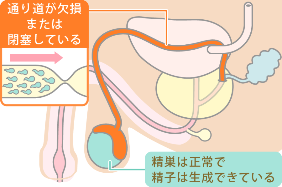 精子の製造と射精の仕組み｜【浜松町第一クリニック】