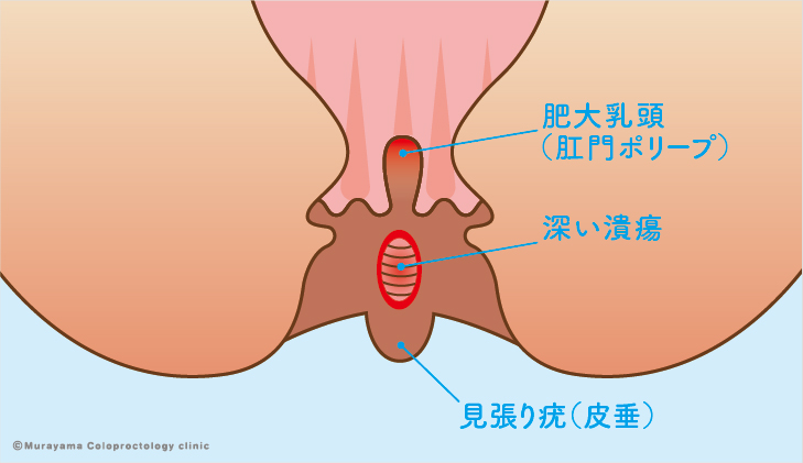 まさに神秘！ 地球の肛門といっても差し支えないポルトガルの超巨大ダム映像 | ロケットニュース24