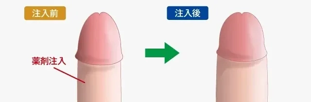 あの『ペニスの形』には意味があるの？ちんこの亀頭があの形の理由【ラブコスメ】