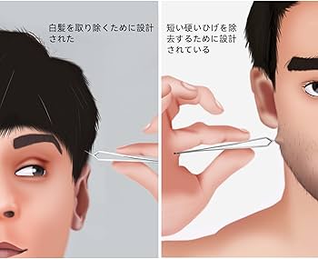 ヒゲ抜きによる肌荒れがどこよりもわかる！7つの肌トラブルと5つの改善方法！ | まるわかりメンズ脱毛