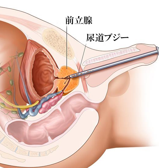 ＧＳＭの説明図 VulvaPuppet.comの承認でました。 -