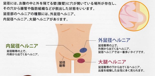 福岡県の鼠径ヘルニア(そけいヘルニア)/脱腸の専門治療が可能な病院 71件 【病院なび】