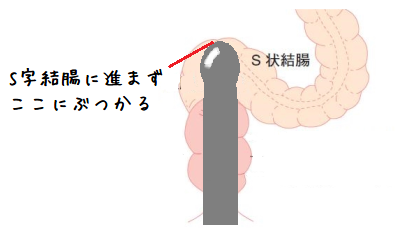 今さら聞けない「S字結腸」について解説！傑作結腸責め3選｜BLニュース ちるちる