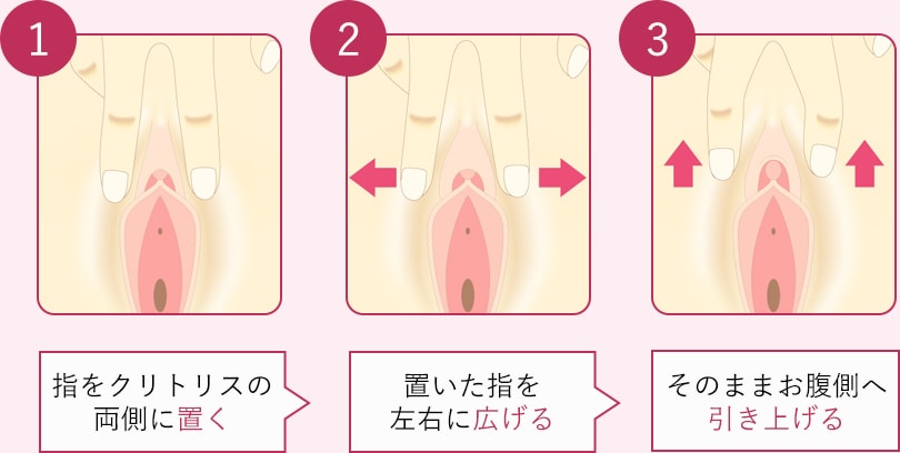 クリトリス包茎手術｜見た目・感度を改善！女性器整形「クリトリス包茎手術」の効果・経過・ダウンタイムとは｜美容整形・美容外科のTAクリニックグループ