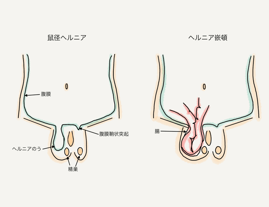 自慰行為で免疫力は上がる？健康面でのメリットや適切な頻度について解説 |【公式】ユナイテッドクリニック