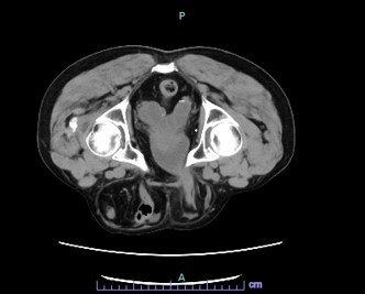 薬院 アロマ 鼠径部に関するエステサロン Plaisir