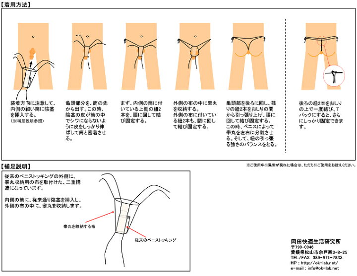 症例11 41歳男性 治療内容・・・ペニス上反り形成術・屈曲ペニス修正術