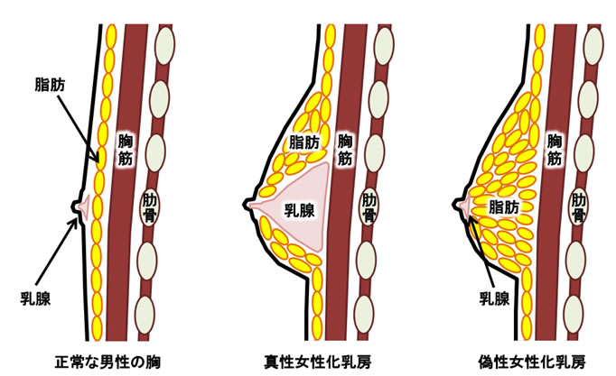 夏に発生！ 男たちの【透け乳首問題】最適解はコレだ！ - ライフ・文化 -