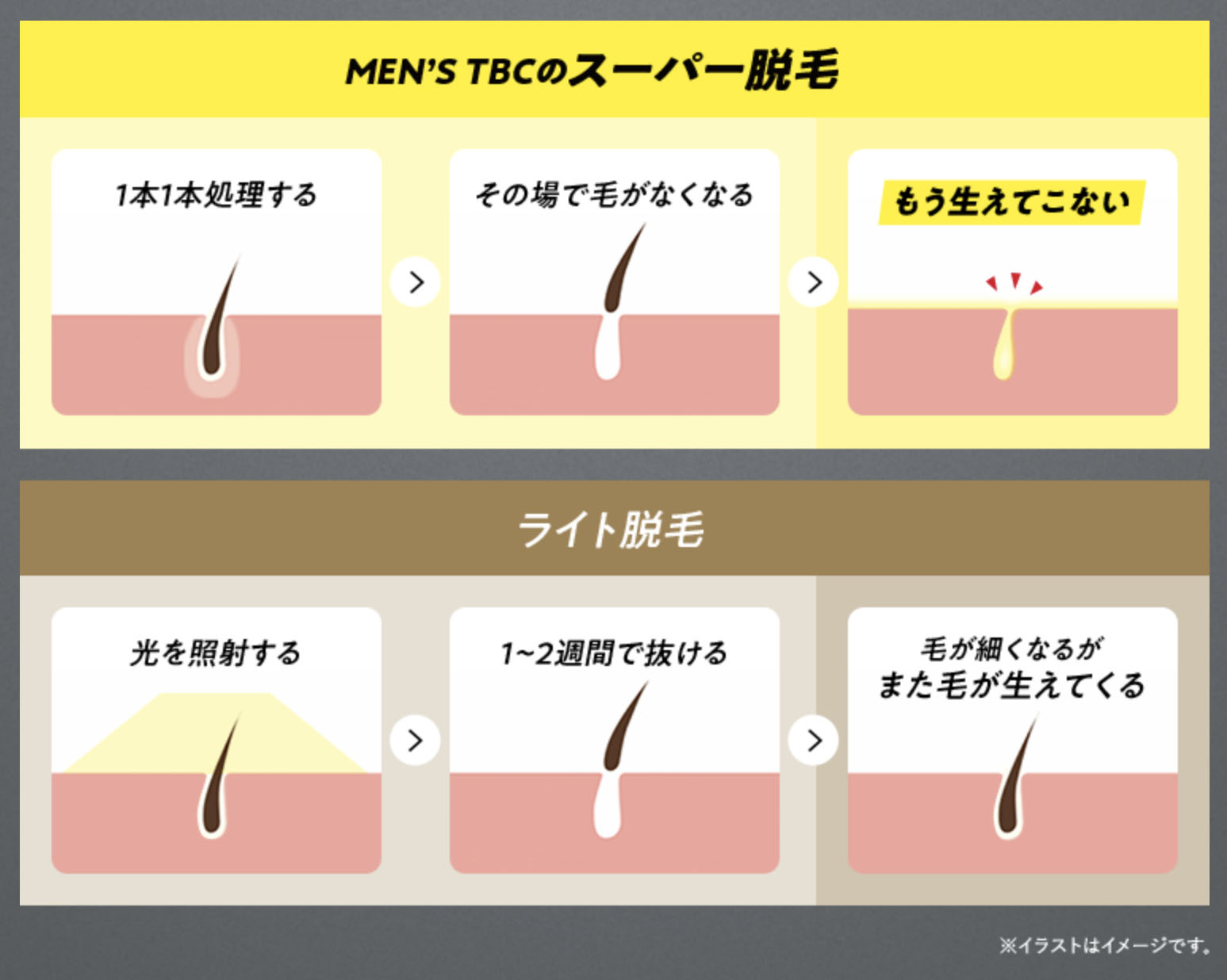 京都でヒゲ脱毛ができるおすすめクリニック＆サロン12選【2024年最新】料金や回数・デメリットも紹介 | The Style